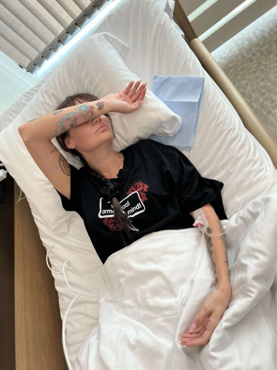 (mini) kõhuplastika: before and after