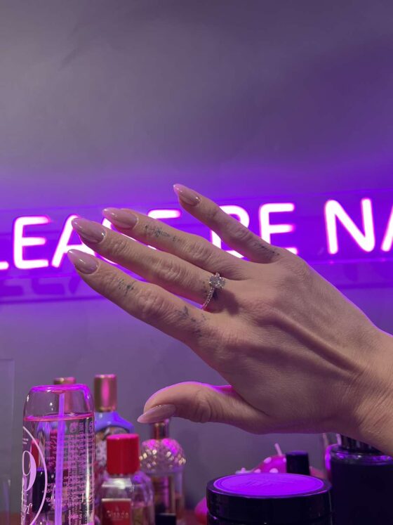 vabandage, aga kas teie mehed on närvihaiged või?